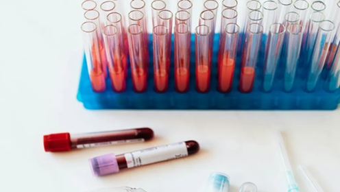 研究表明，在诊断前三年内可以在血液中检测到癌症 DNA